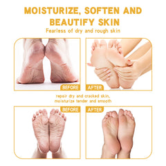 Shurun Cream For Chapped Skin Foot Care Moisturizing And Anti-cracking