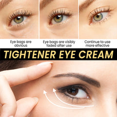 Wrinkle Removing Eye Cream